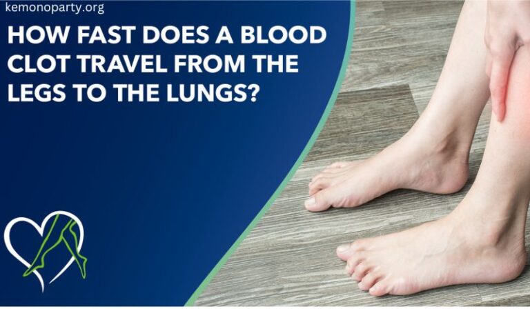 How Fast Does a Blood Clot Travel From the Leg to the Lungs